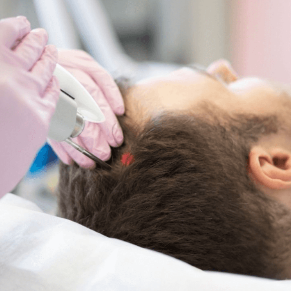 Laserterapia Capilar Trikhos Tratamentos Capilares Laserterapia Capilar Trikhos Tratamentos Capilares